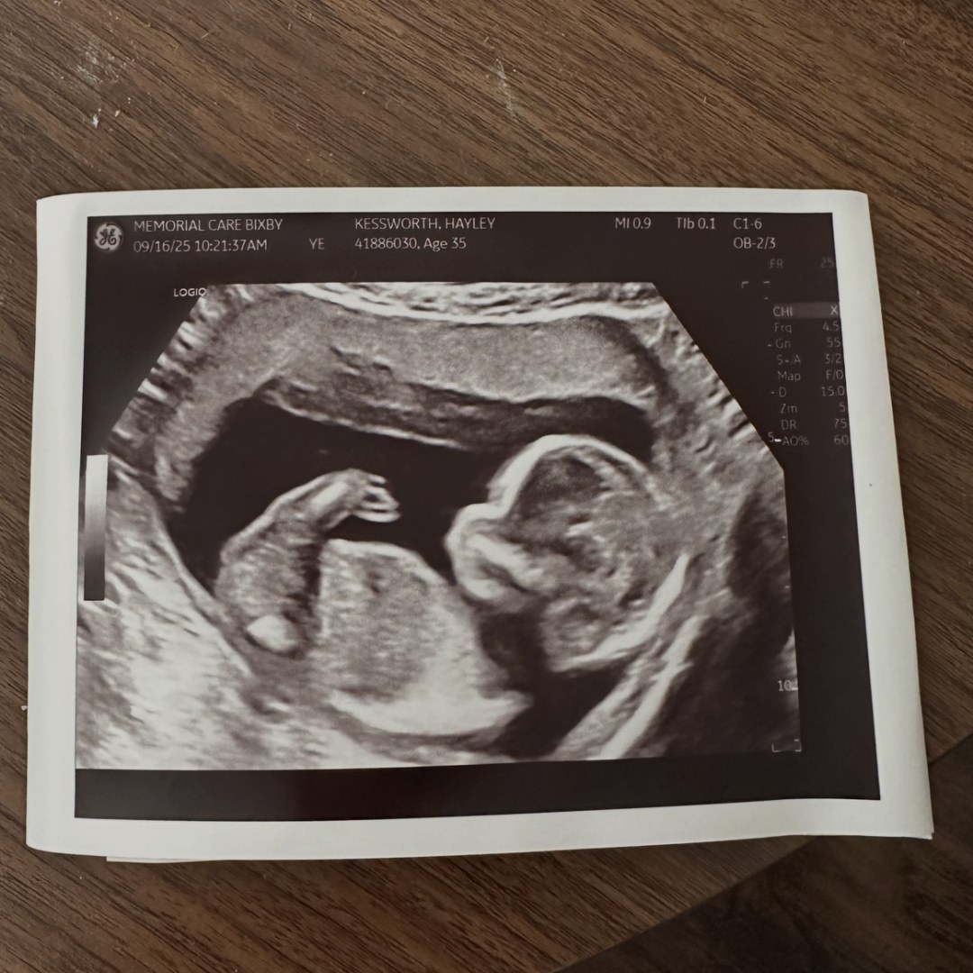 Photo shared by Hayley for their Babylist baby registry.