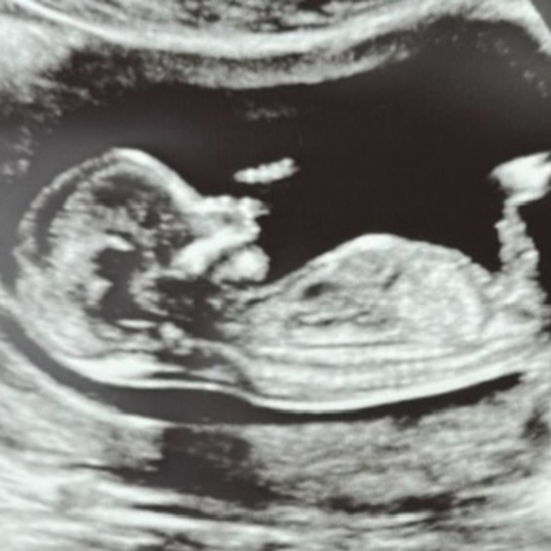 Photo shared by Kaitlyn for their Babylist baby registry.
