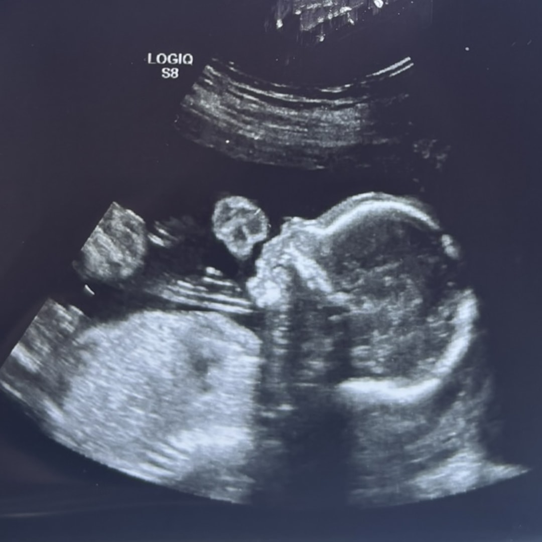 Photo shared by Carys for their Babylist baby registry.