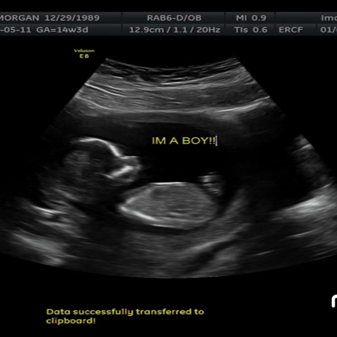 Photo shared by Morgan for their Babylist baby registry.