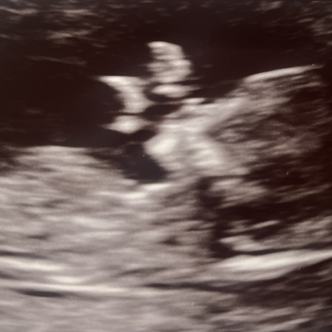 Photo shared by Victoria for their Babylist baby registry.