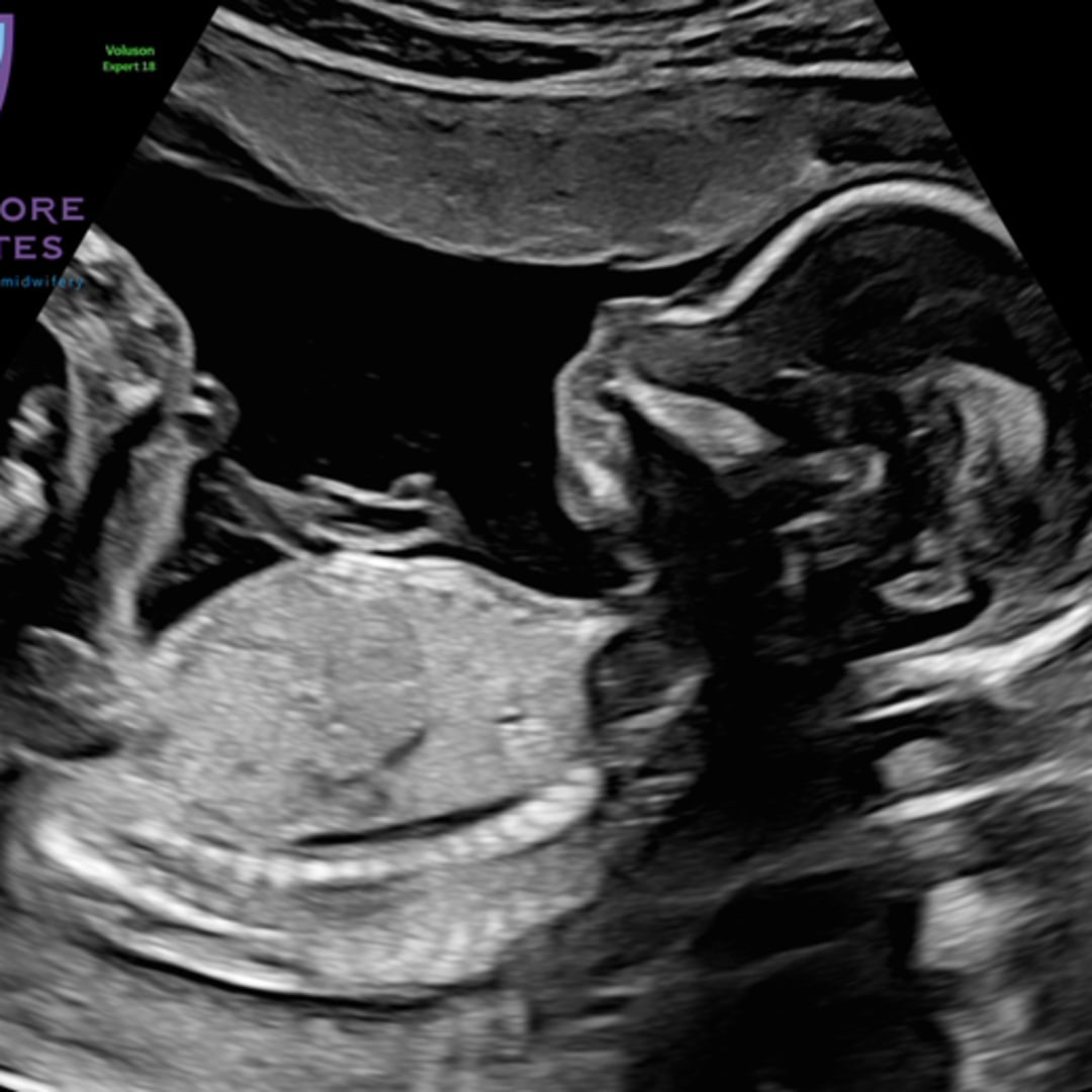 Photo shared by Ally for their Babylist baby registry.