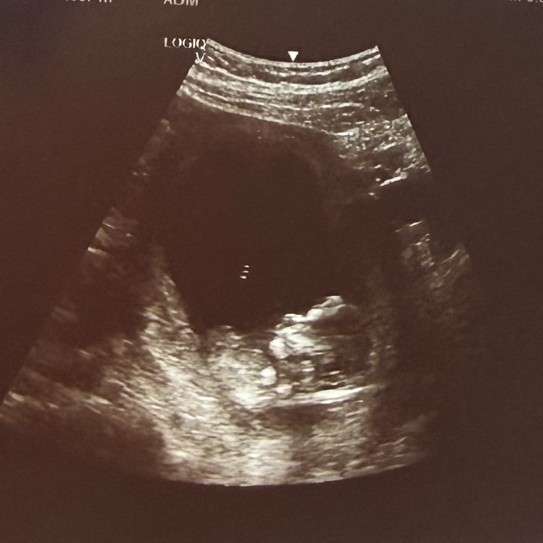 Photo shared by Jasmine for their Babylist baby registry.