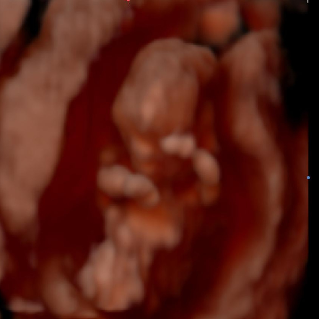 Photo shared by Jocelyn for their Babylist baby registry.