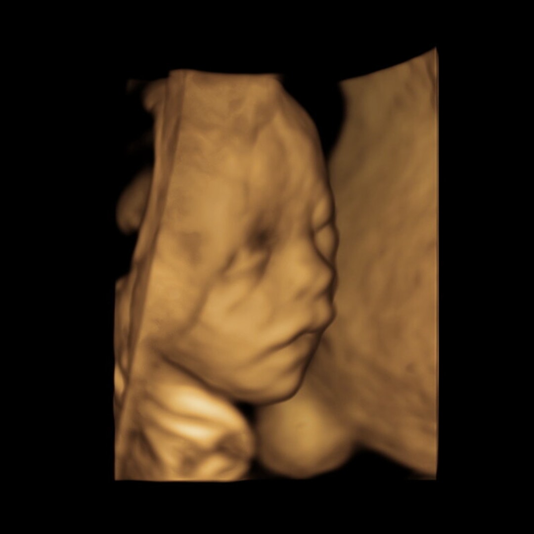 Photo shared by Misty for their Babylist baby registry.