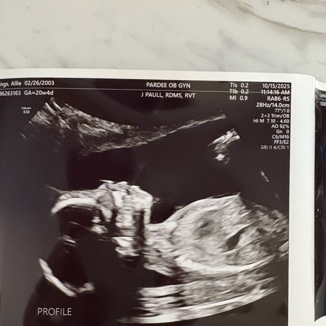 Photo shared by Allie for their Babylist baby registry.
