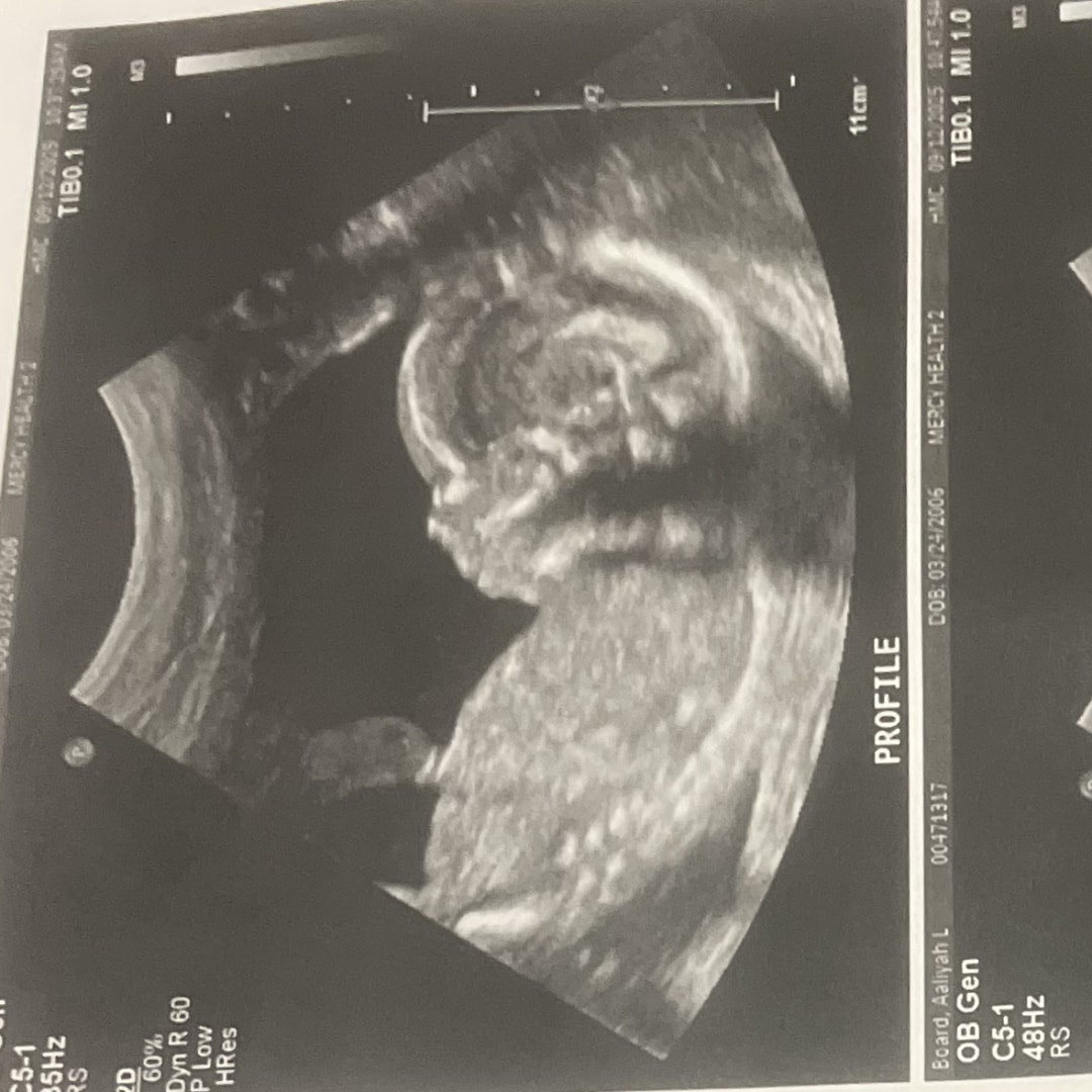 Photo shared by Aaliyah for their Babylist baby registry.
