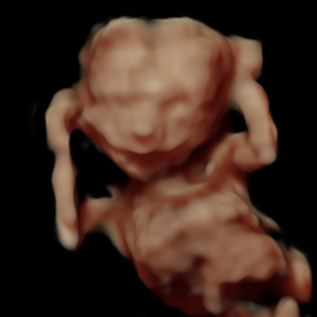 Photo shared by Ambrea for their Babylist baby registry.