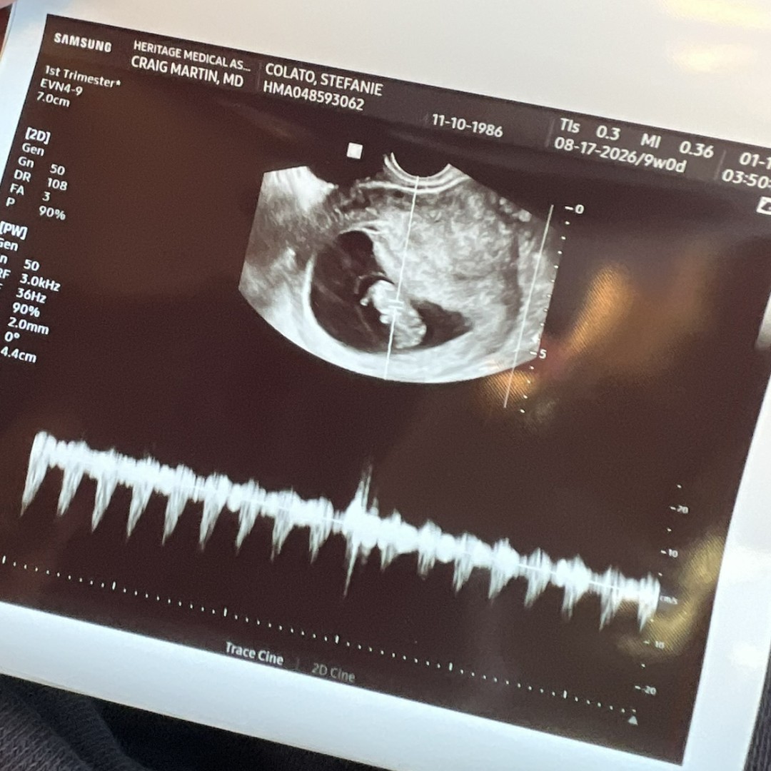 Photo shared by Stef for their Babylist baby registry.