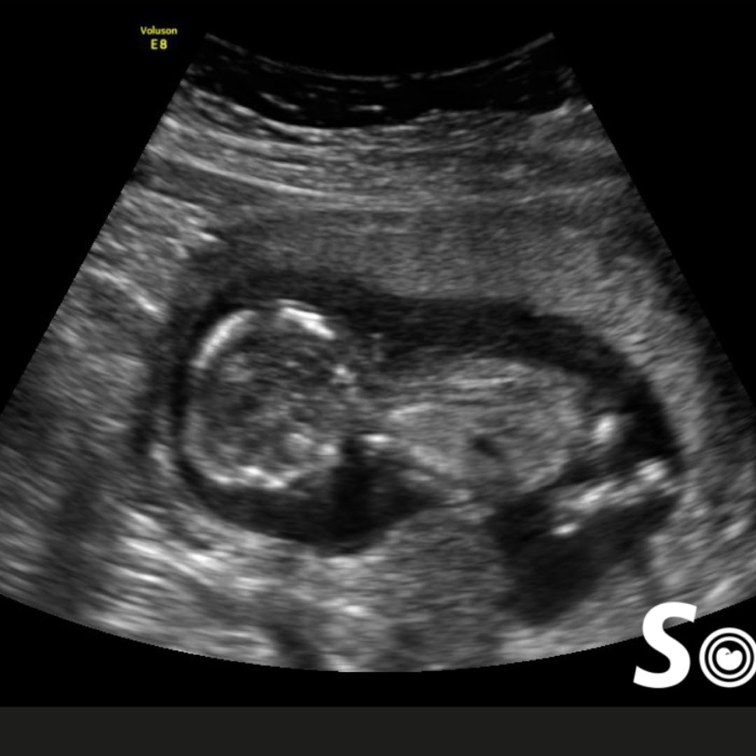 Photo shared by Lucy for their Babylist baby registry.