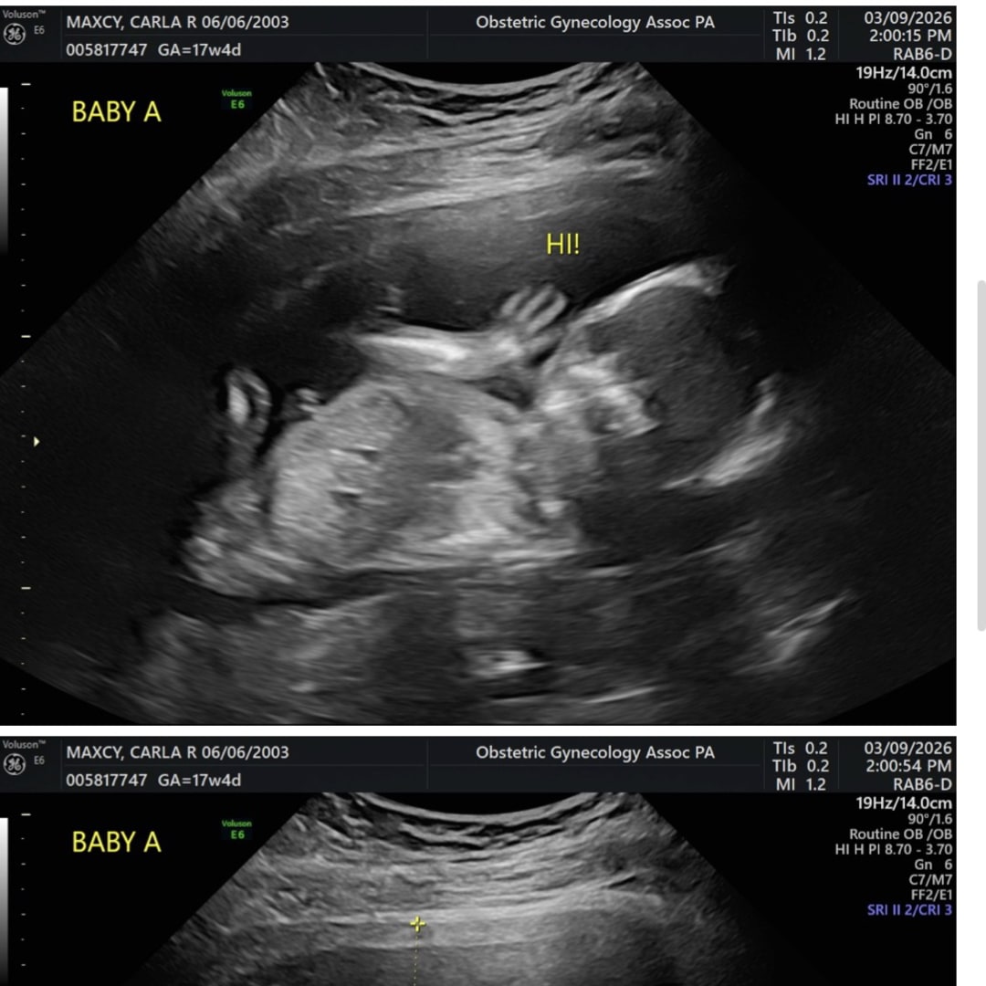 Photo shared by Carla for their Babylist baby registry.