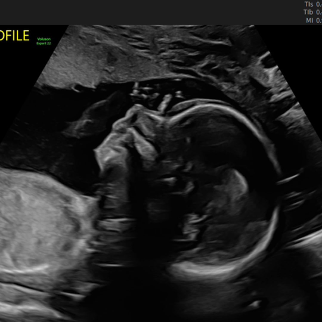 Photo shared by Sarah for their Babylist baby registry.