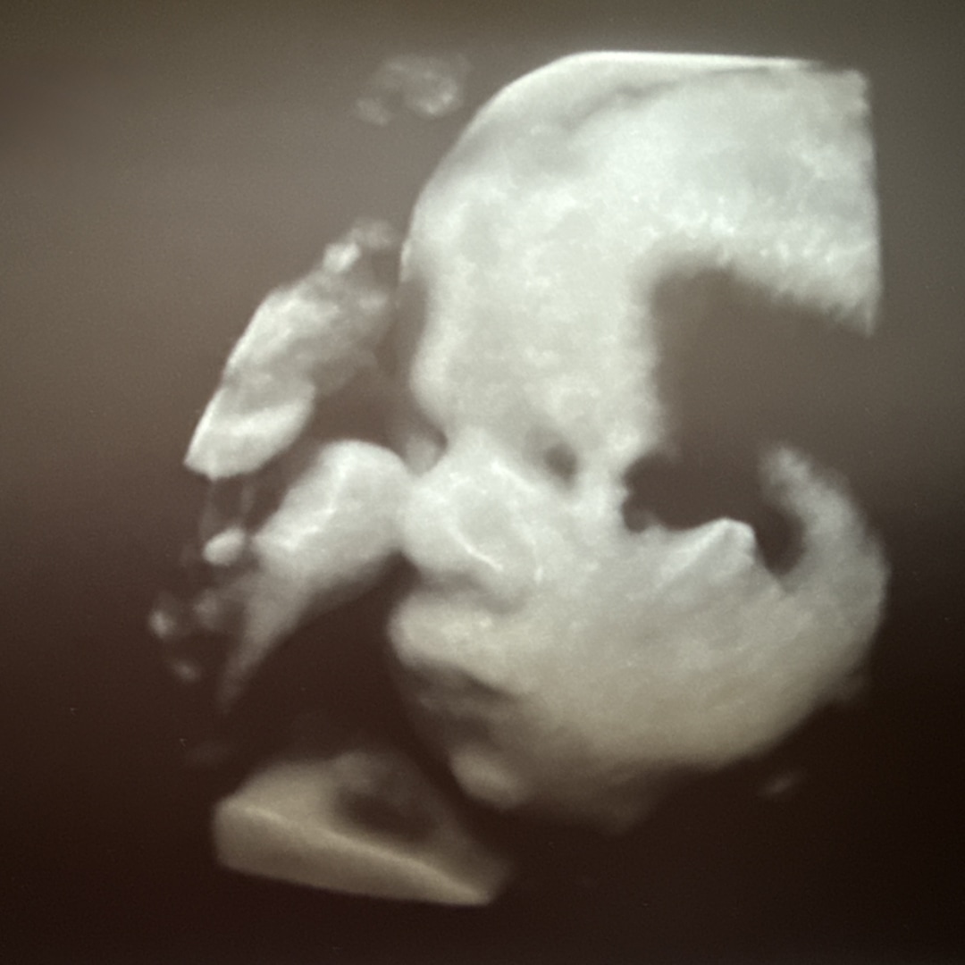 Photo shared by Patrick for their Babylist baby registry.