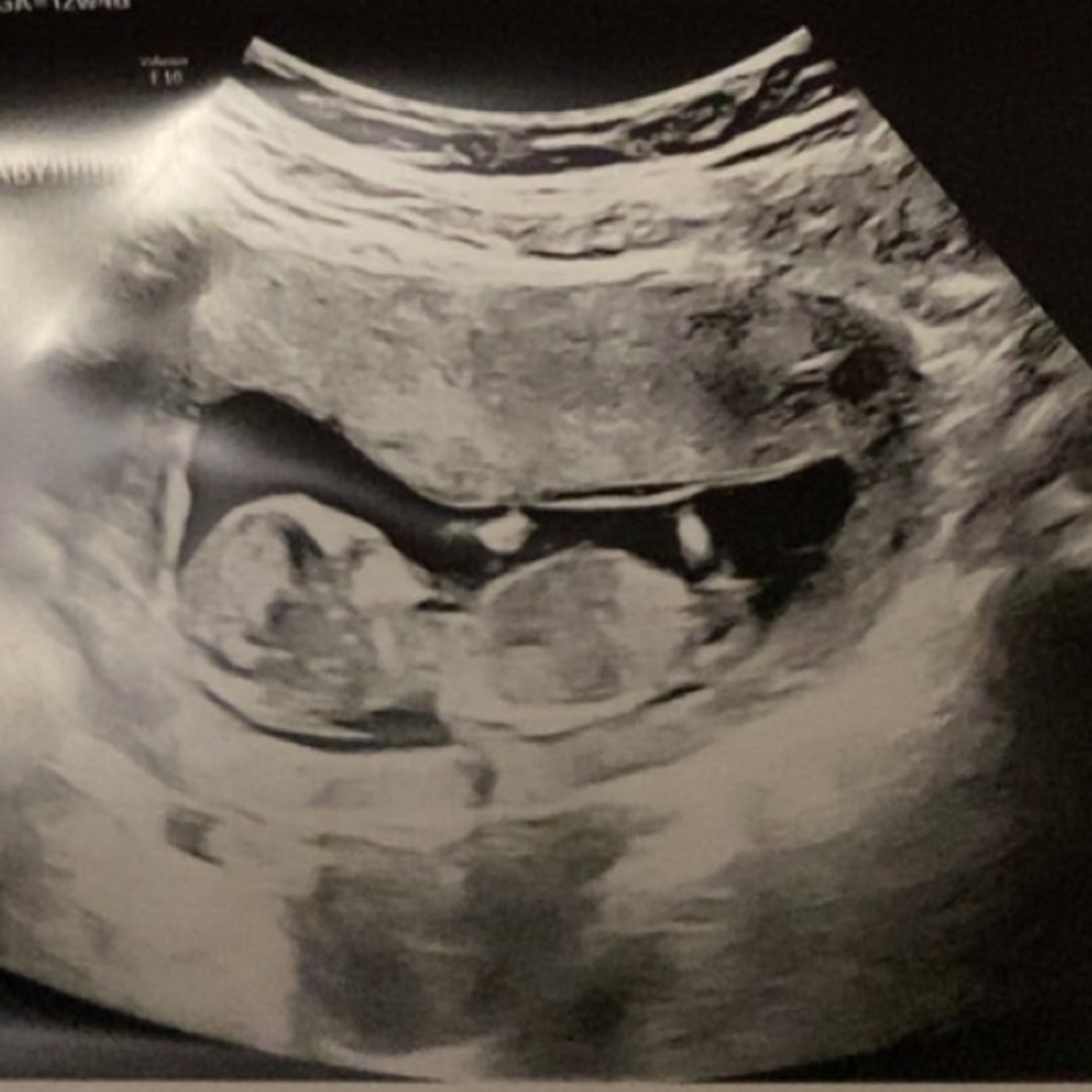 Photo shared by Kaylee for their Babylist baby registry.