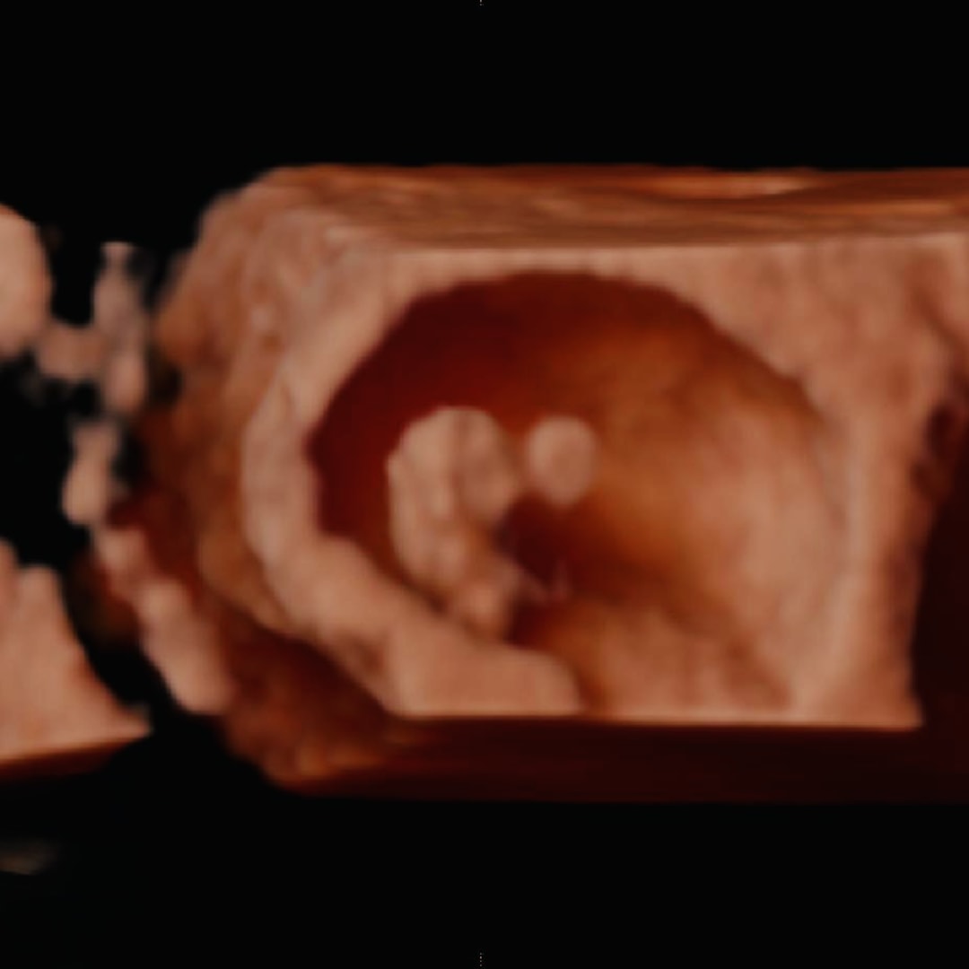 Photo shared by Sarah for their Babylist baby registry.