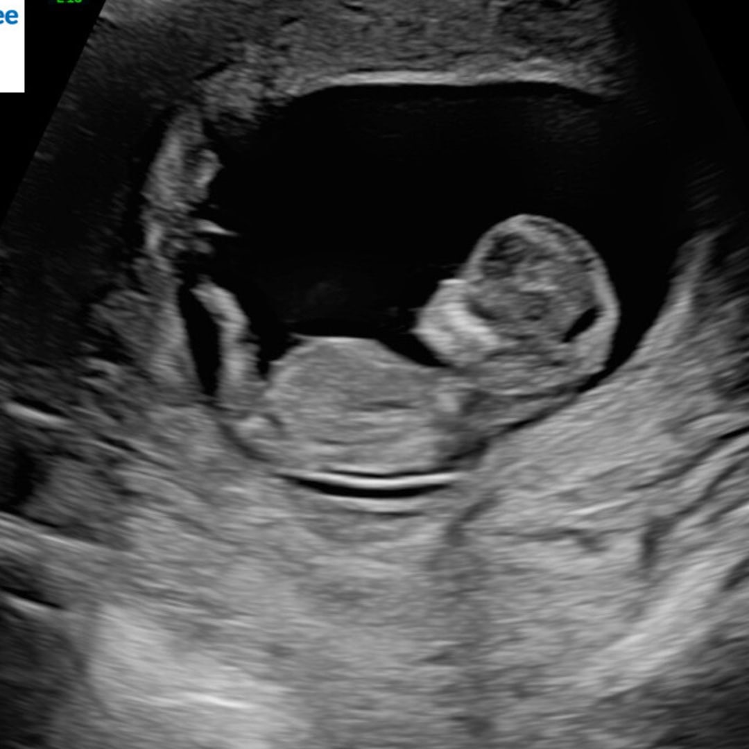 Photo shared by Casandra for their Babylist baby registry.