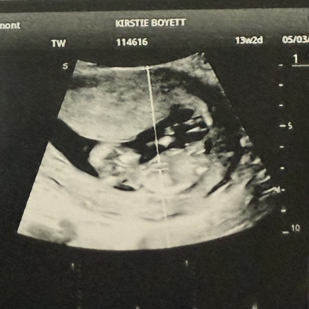 Photo shared by Kirstie for their Babylist baby registry.