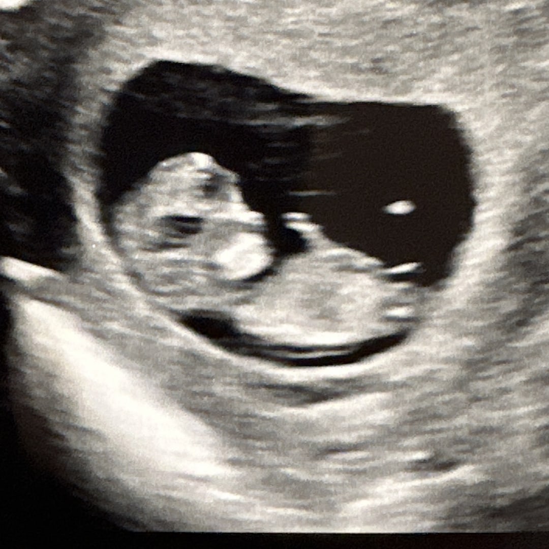 Photo shared by Sara for their Babylist baby registry.