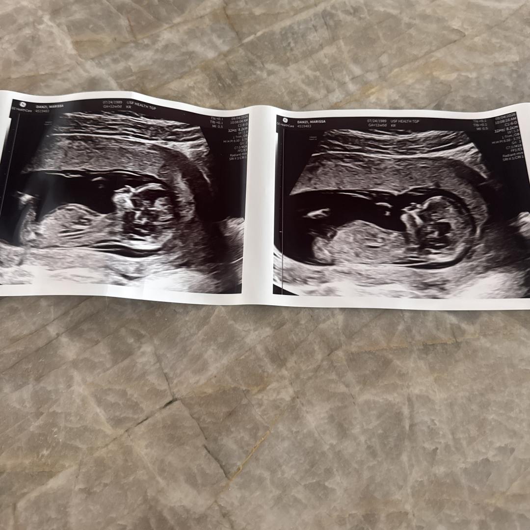 Photo shared by Marissa for their Babylist baby registry.