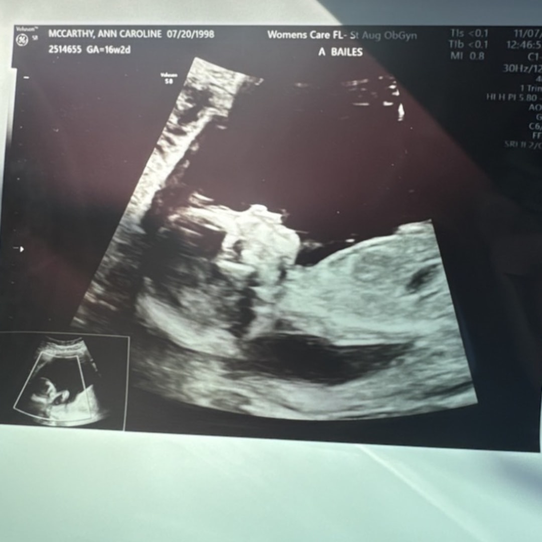 Photo shared by Annie for their Babylist baby registry.