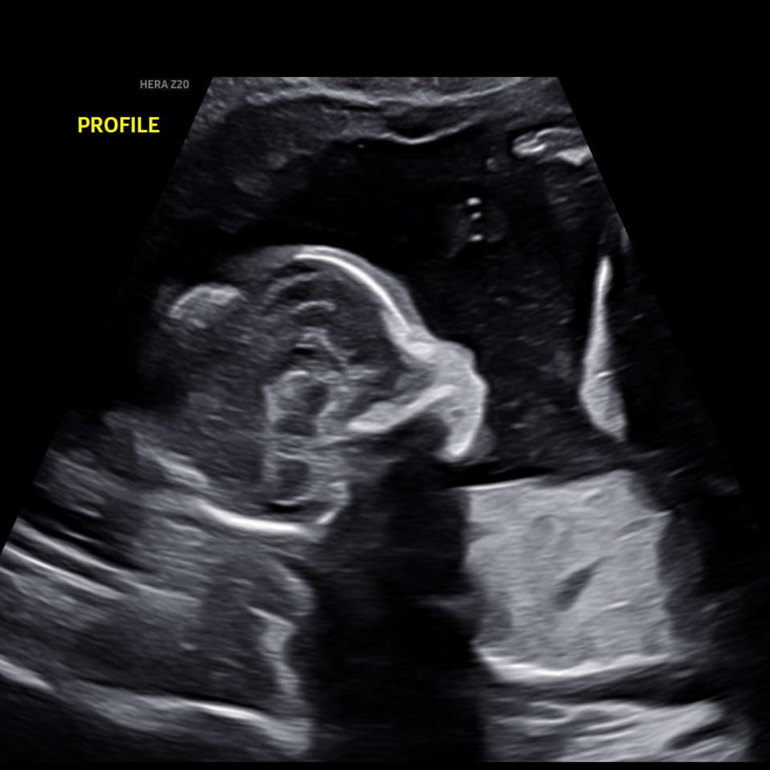 Photo shared by Shanise for their Babylist baby registry.