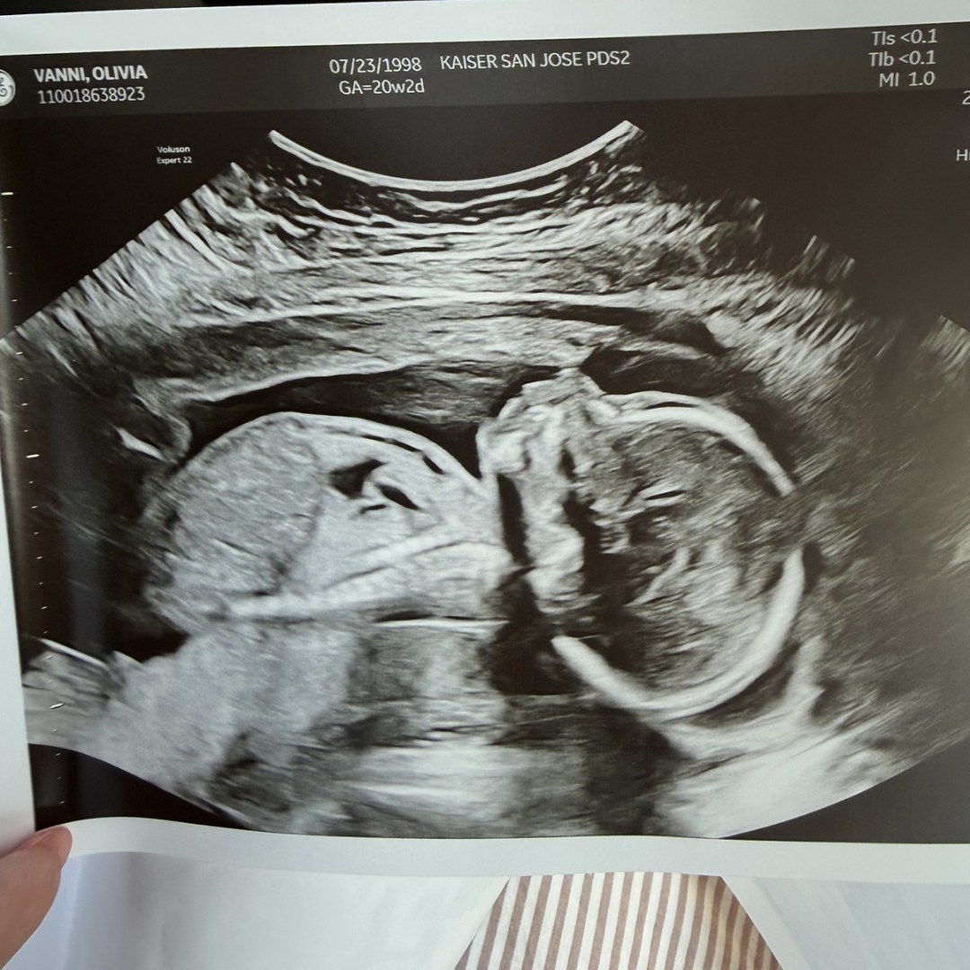 Photo shared by Olivia for their Babylist baby registry.