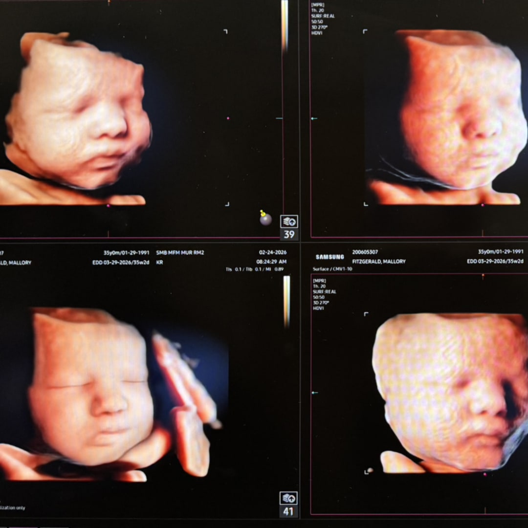 Photo shared by Mallory for their Babylist baby registry.