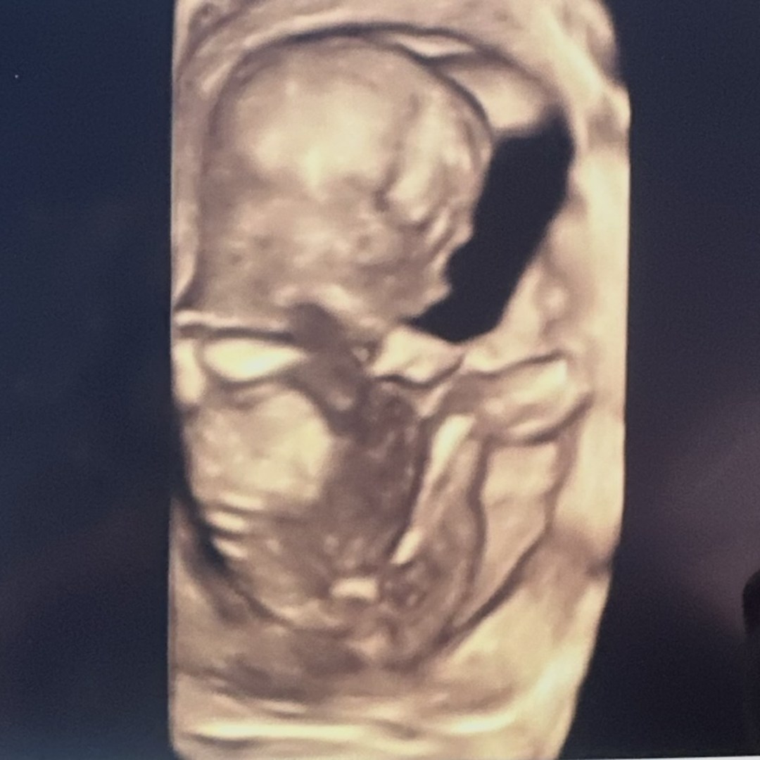 Photo shared by Citlaly for their Babylist baby registry.