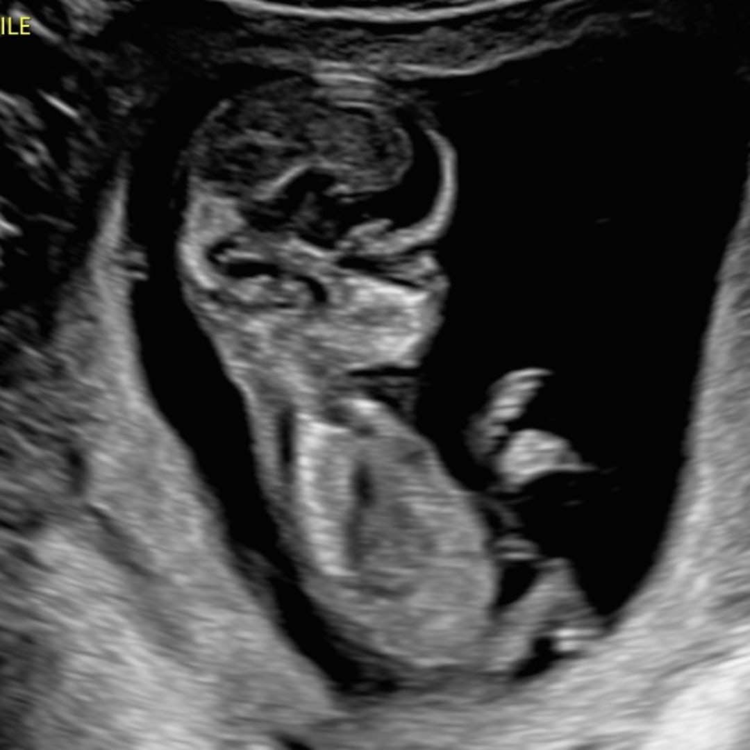 Photo shared by Megan for their Babylist baby registry.
