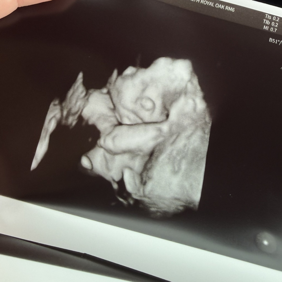 Photo shared by Baylee for their Babylist baby registry.