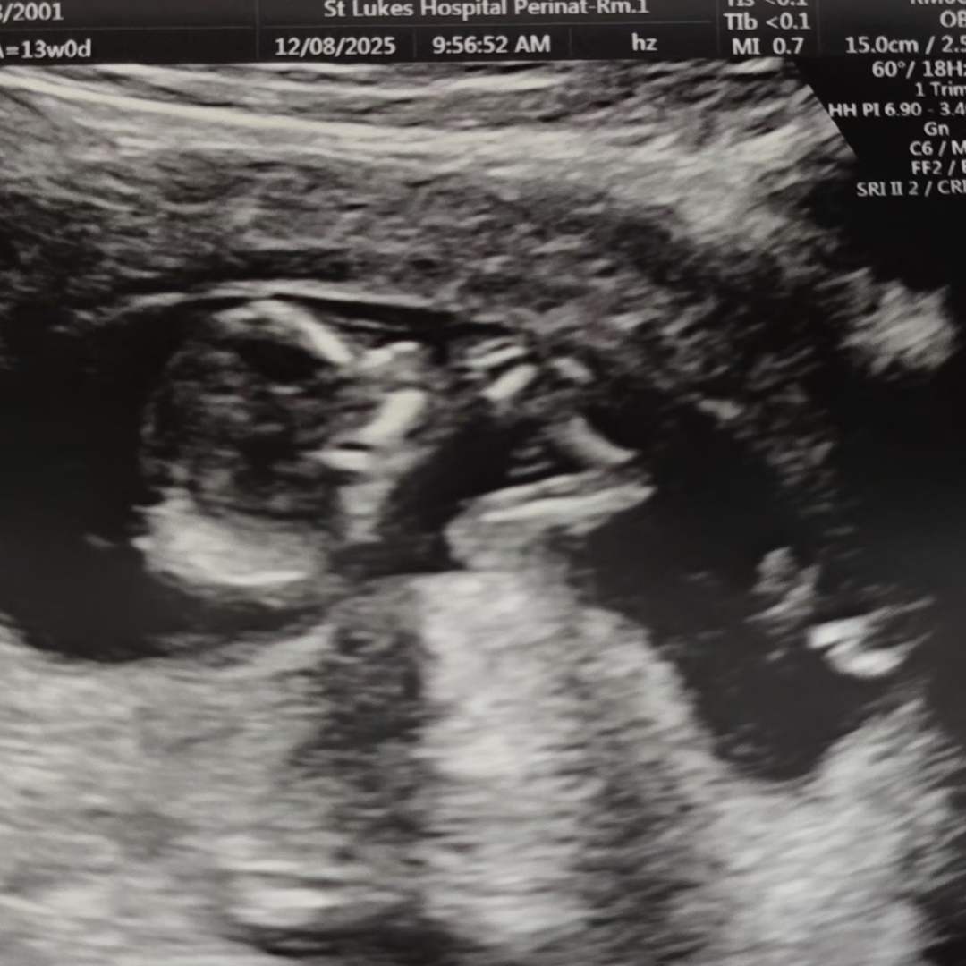 Photo shared by Andrea Petit for their Babylist baby registry.