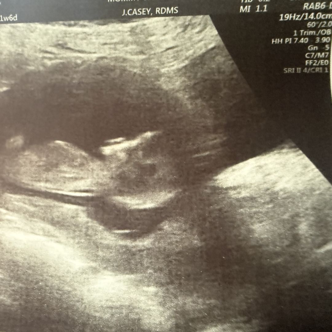 Photo shared by Catherine for their Babylist baby registry.