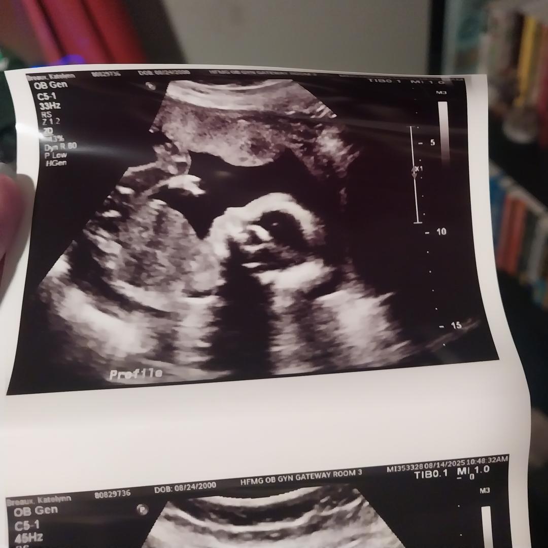 Photo shared by Katelynn for their Babylist baby registry.