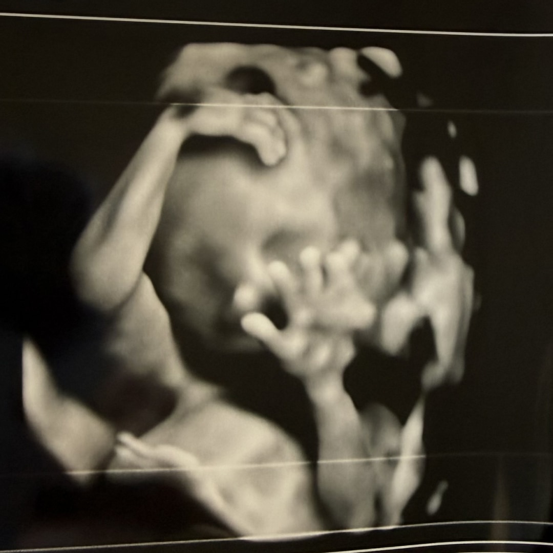 Photo shared by Alyssa for their Babylist baby registry.