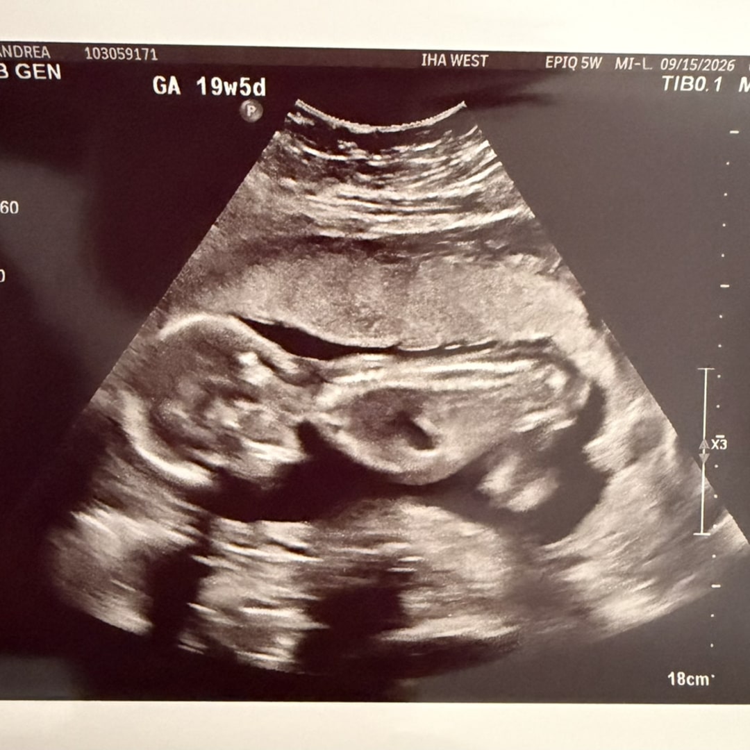 Photo shared by Andrea for their Babylist baby registry.