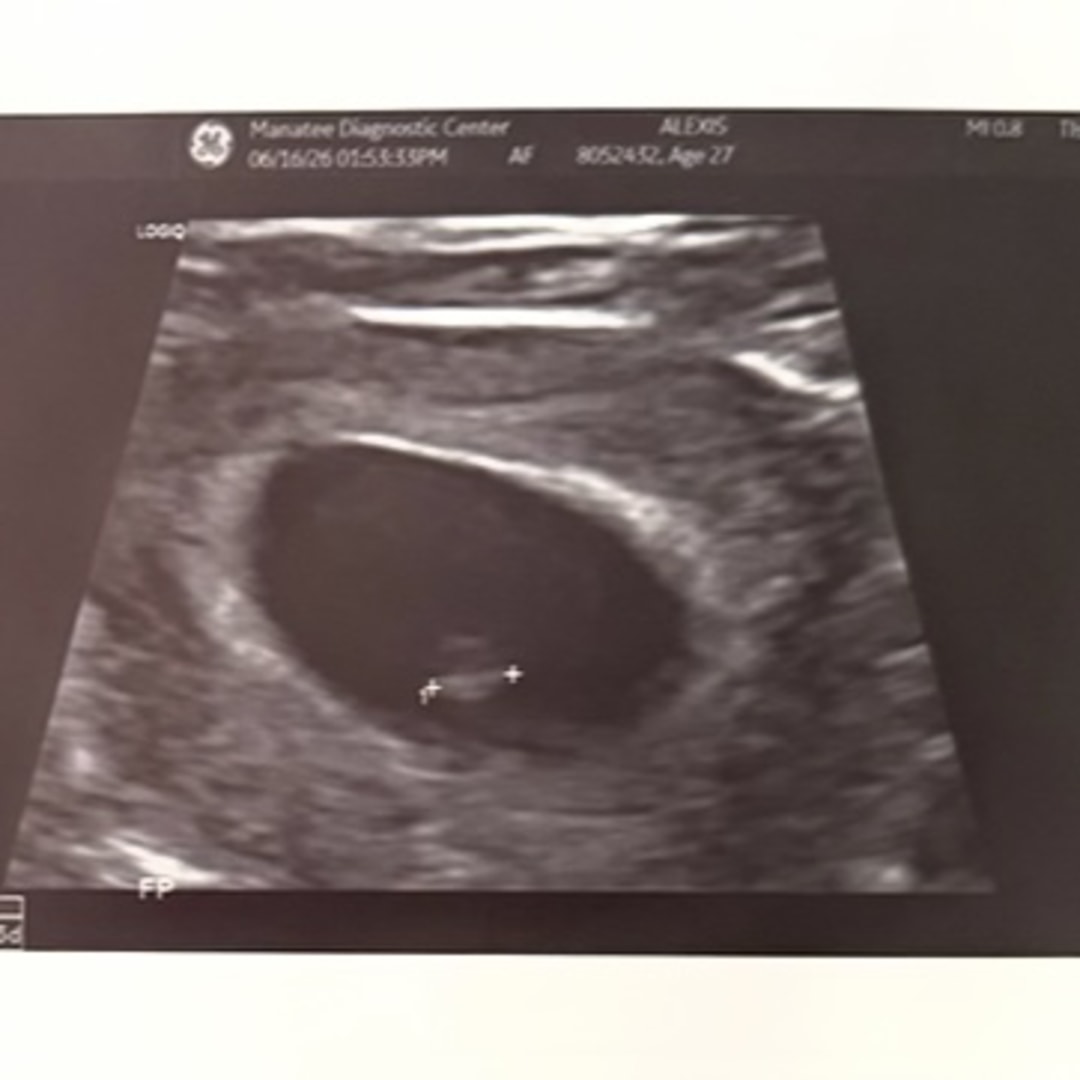 Photo shared by Alexis for their Babylist baby registry.