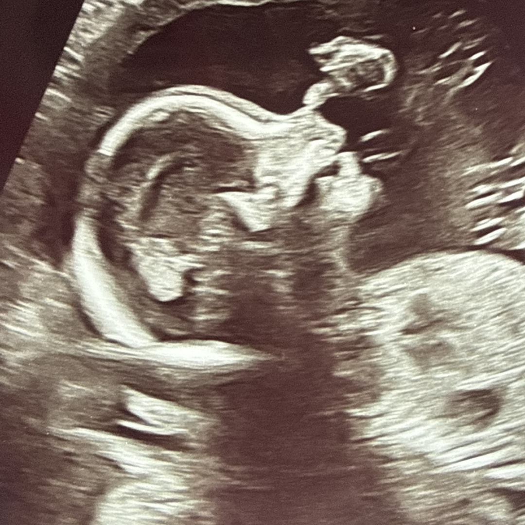 Photo shared by Danielle for their Babylist baby registry.