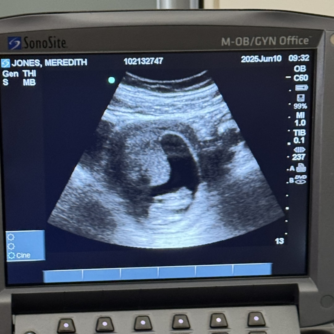 Photo shared by Meredith for their Babylist baby registry.