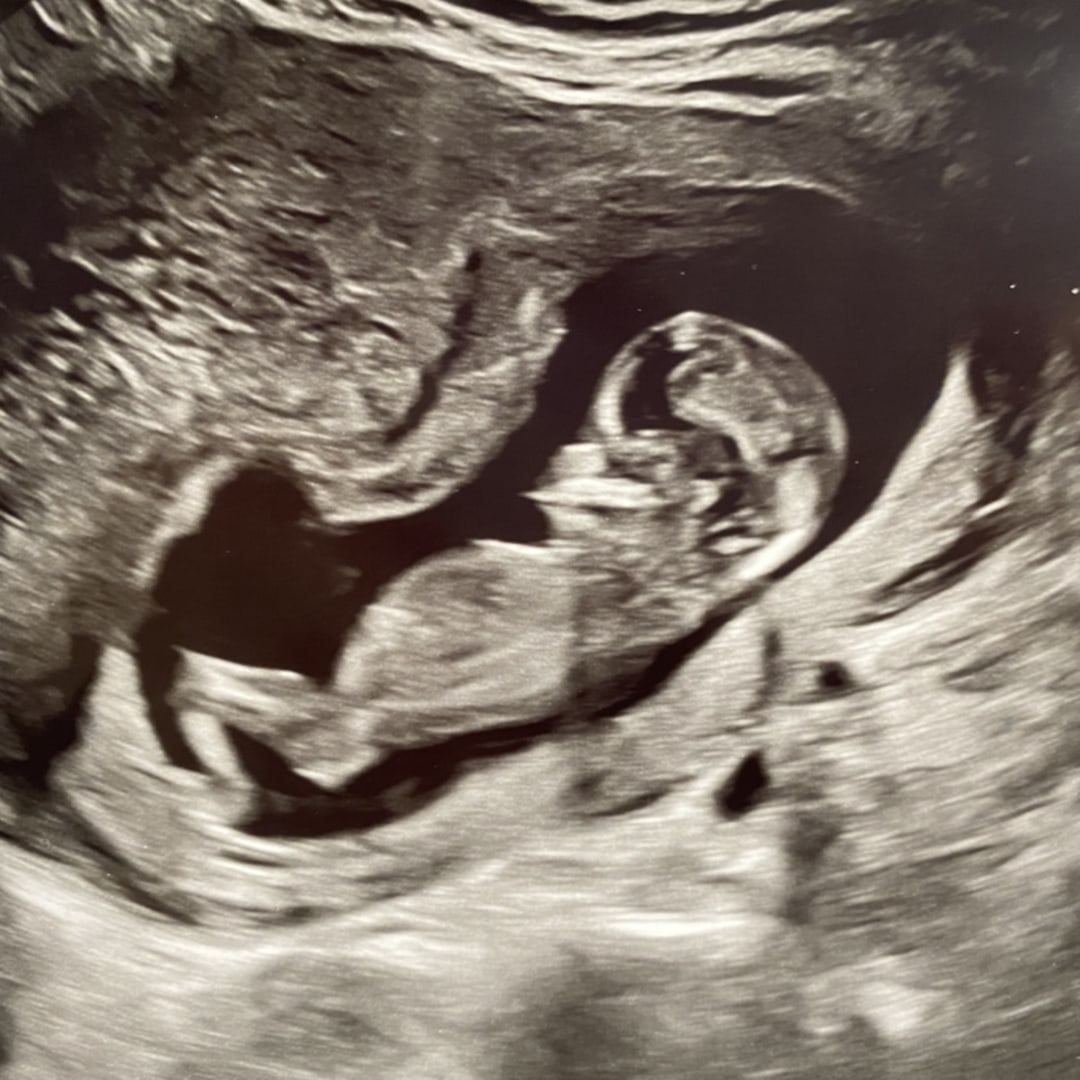 Photo shared by Shanyn for their Babylist baby registry.