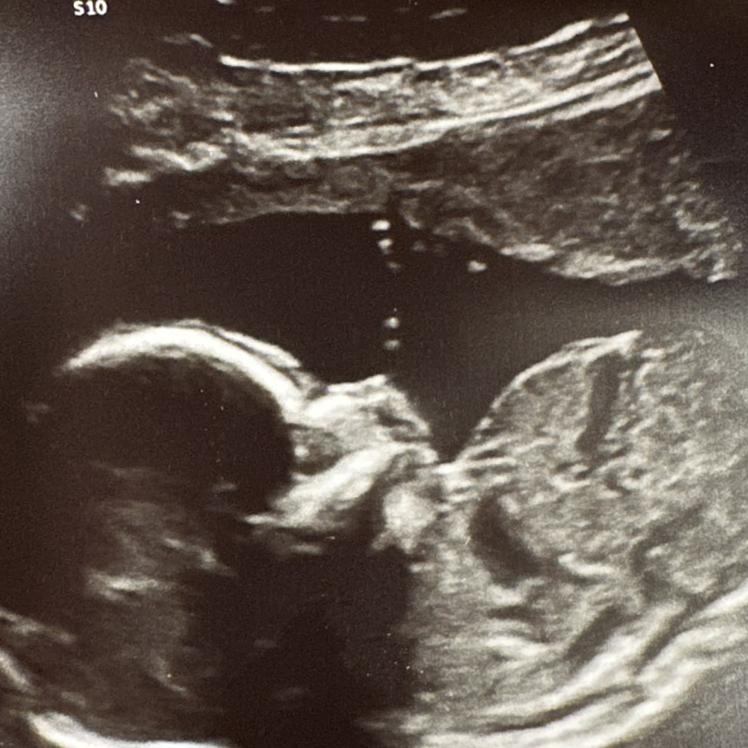 Photo shared by Brooke for their Babylist baby registry.