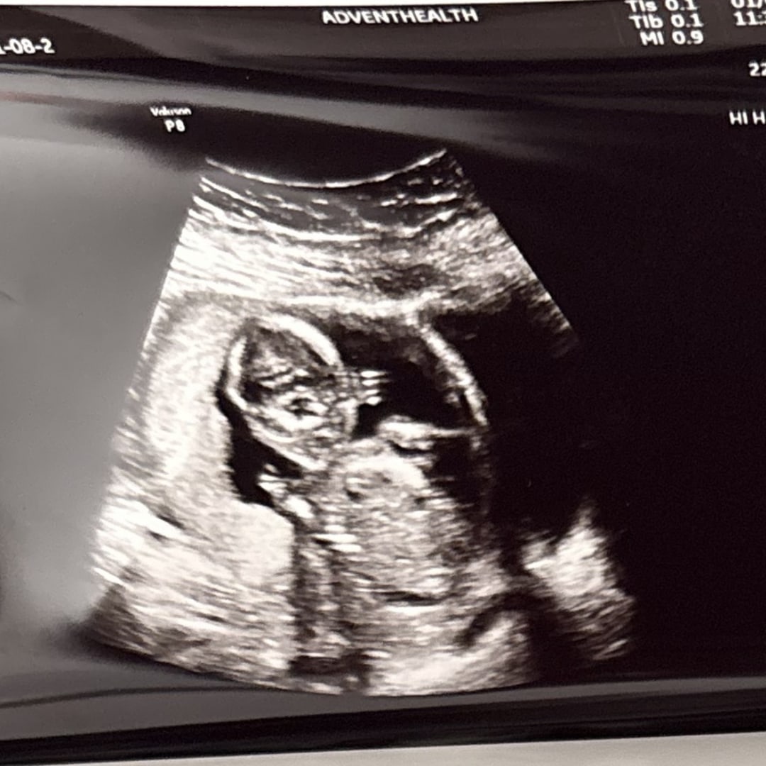 Photo shared by Kelsey for their Babylist baby registry.