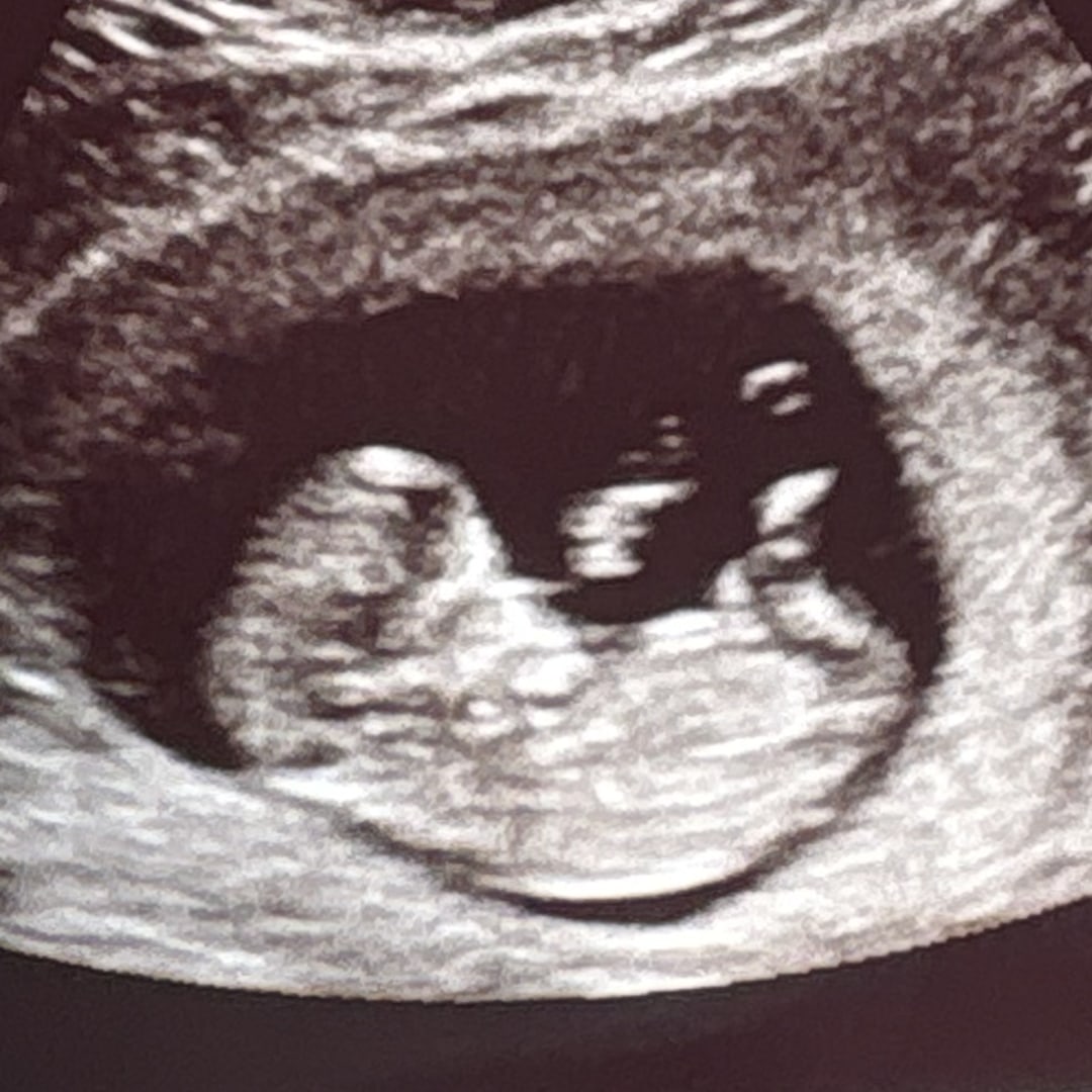 Photo shared by Lillian for their Babylist baby registry.