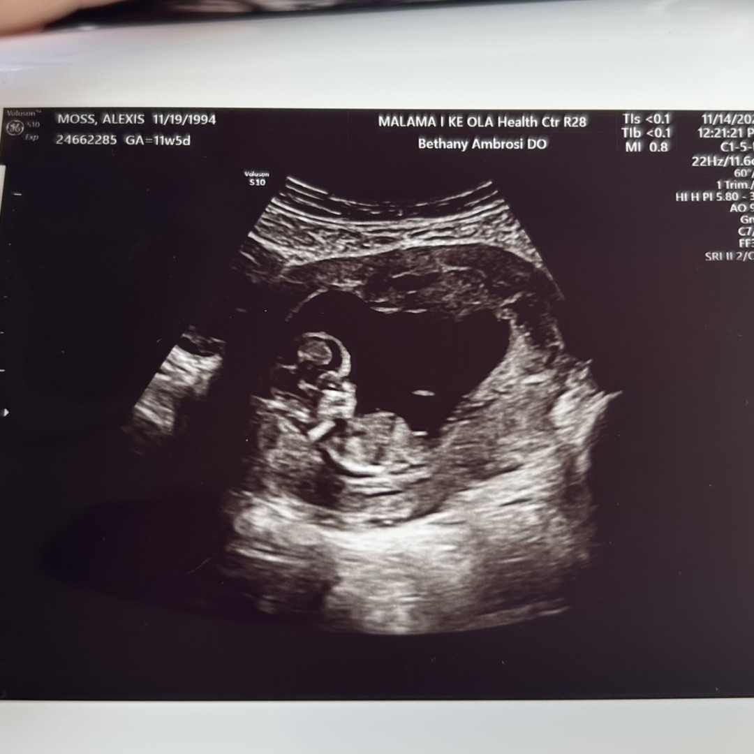 Photo shared by Alexis for their Babylist baby registry.