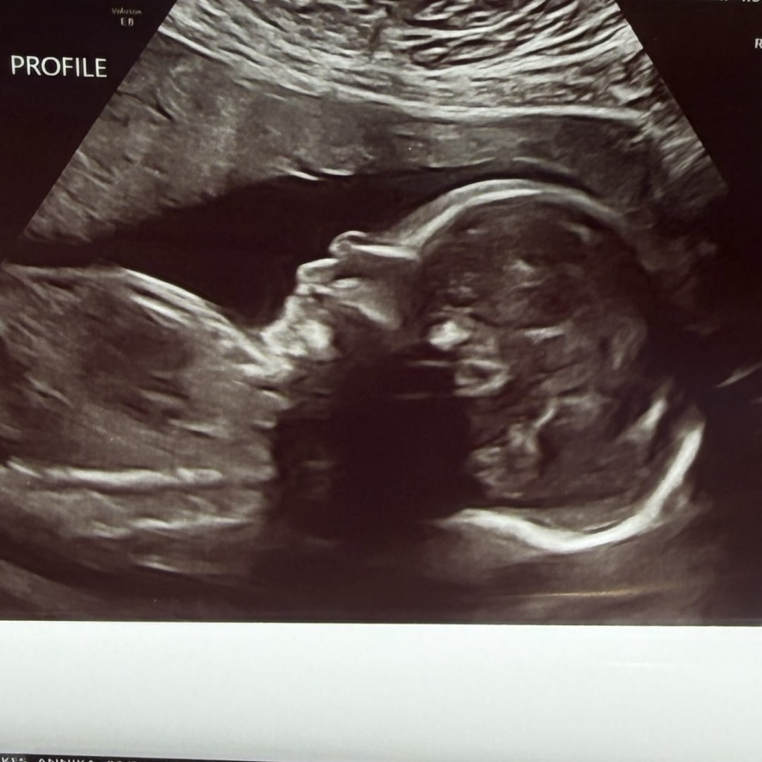 Photo shared by Annika for their Babylist baby registry.