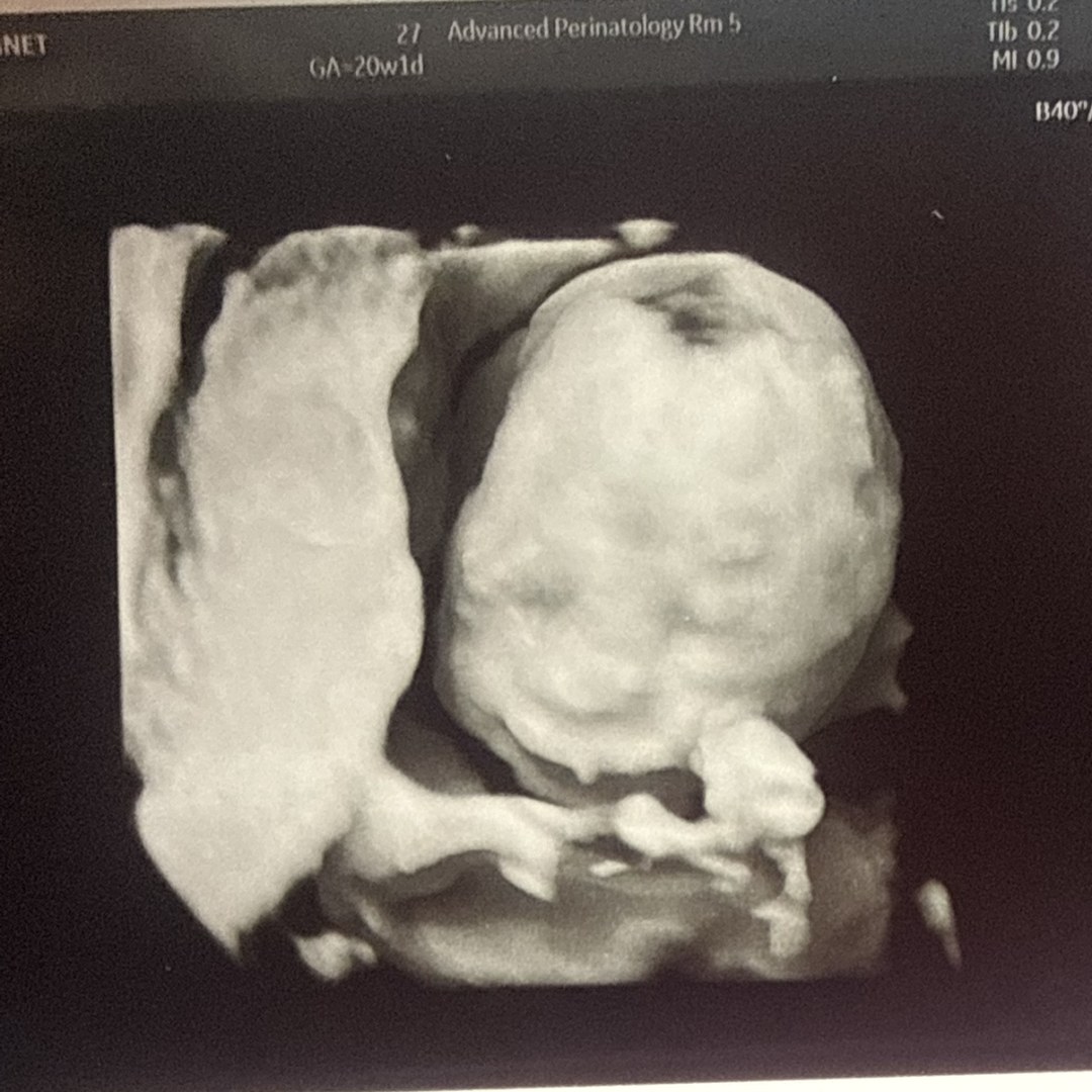Photo shared by Jannet for their Babylist baby registry.