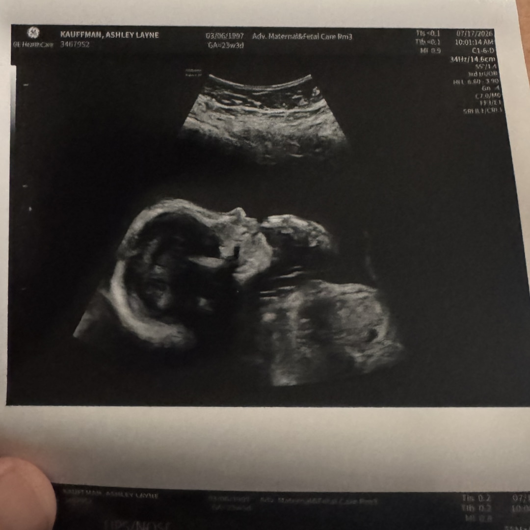Photo shared by Ashley for their Babylist baby registry.