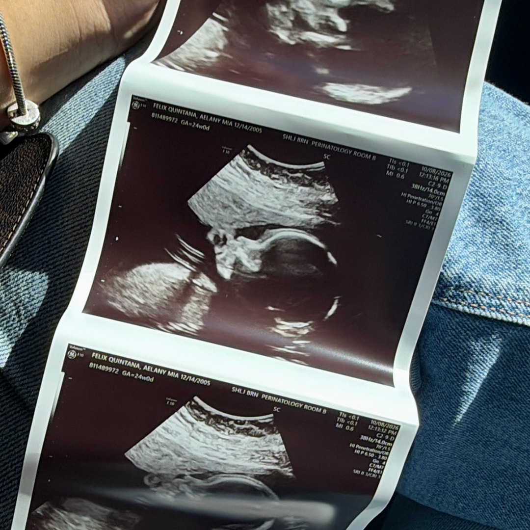 Photo shared by Aelany for their Babylist baby registry.