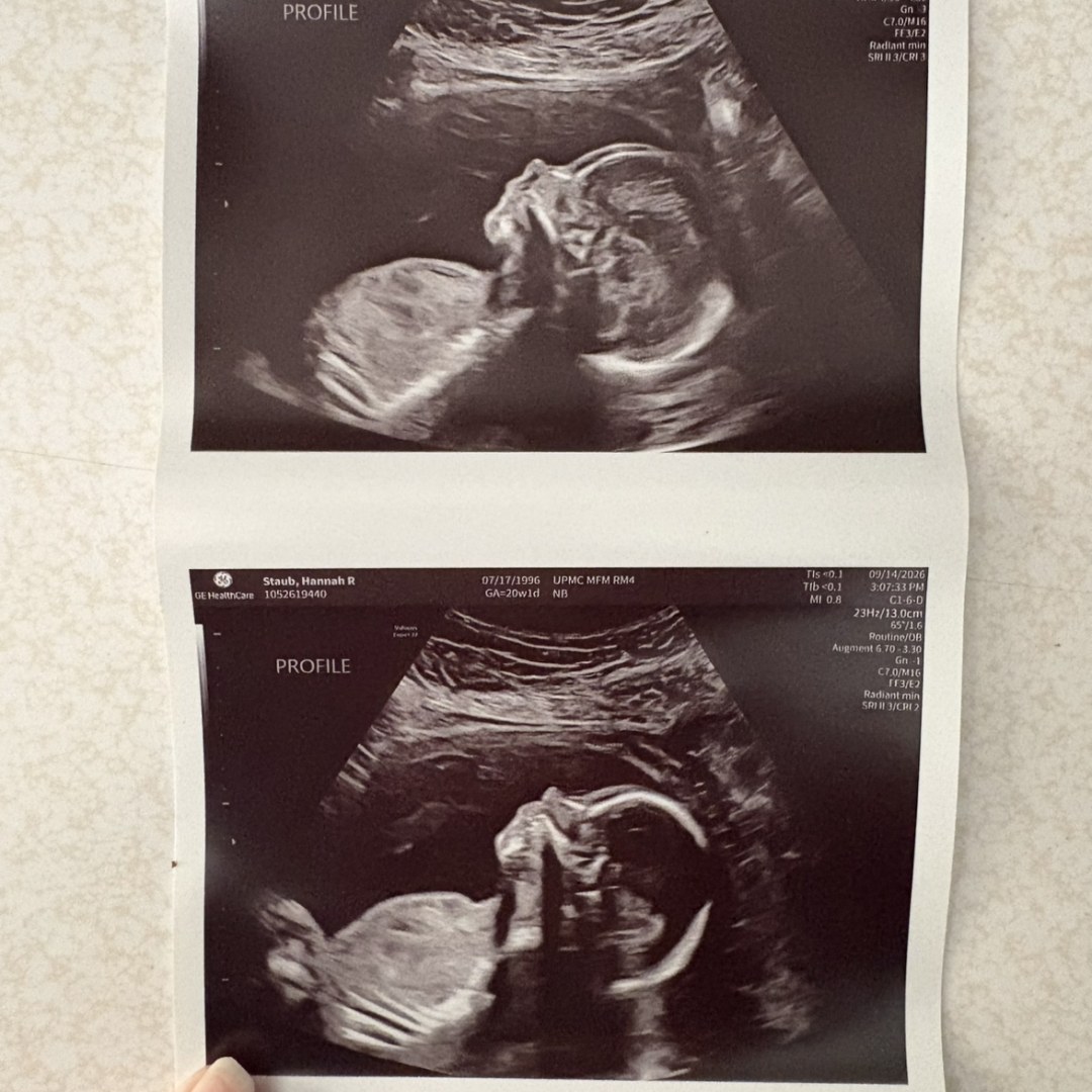 Photo shared by Hannah for their Babylist baby registry.