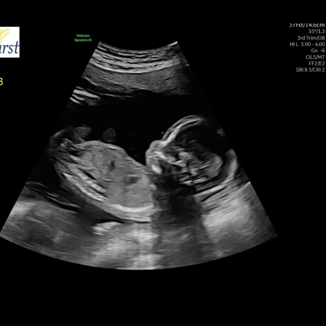 Photo shared by Keely for their Babylist baby registry.