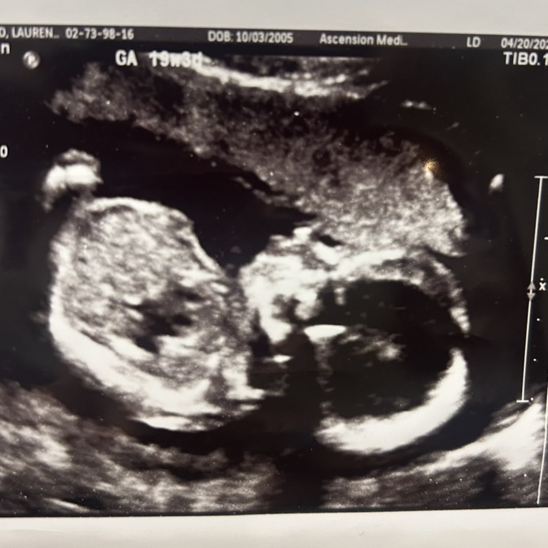 Photo shared by Lauren for their Babylist baby registry.